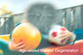 Vision with macular degeneration